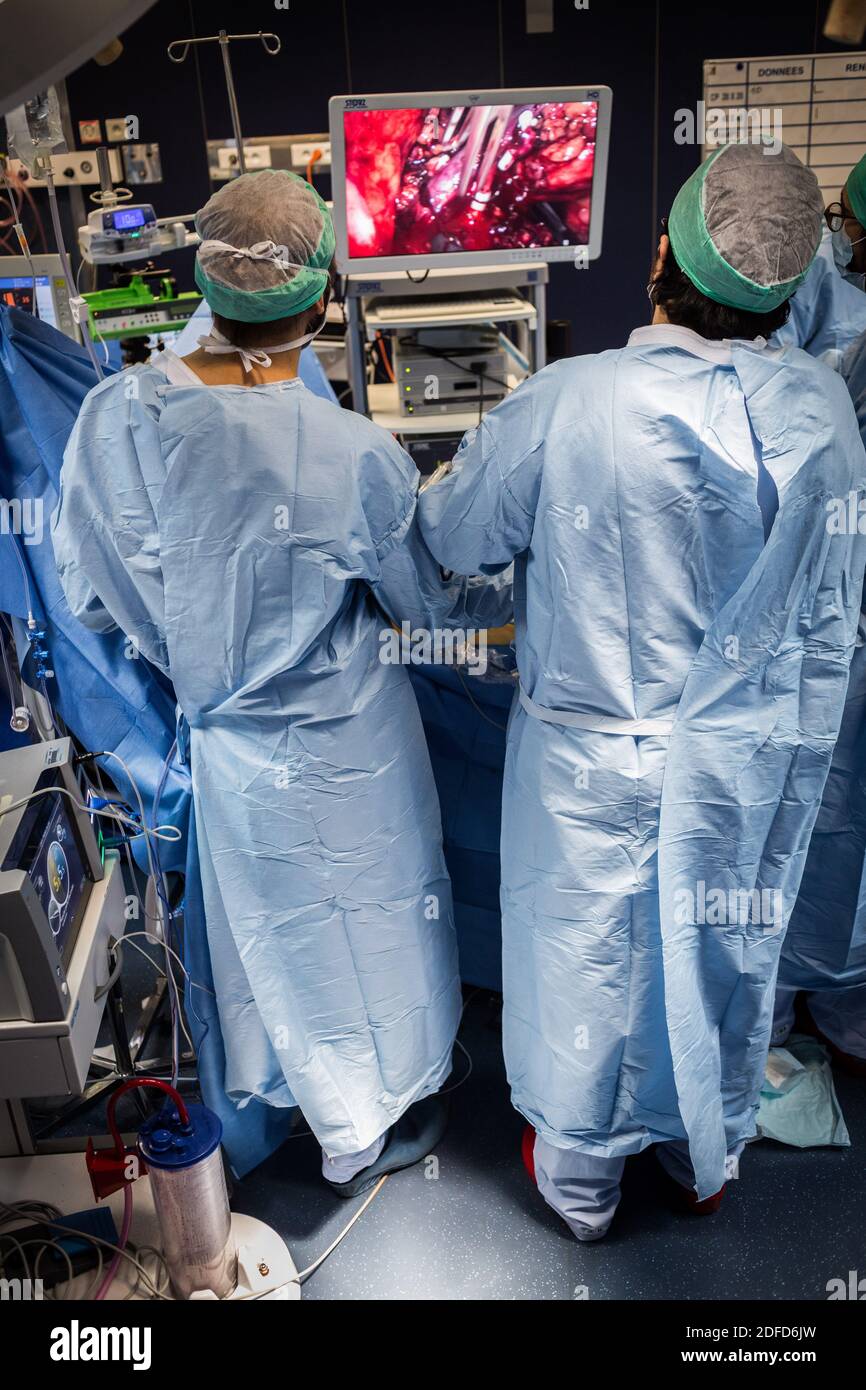 Nierenentfernung durch Laparoskopie von einem lebenden verwandten Spender, Bordeaux Krankenhaus, Frankreich. Stockfoto