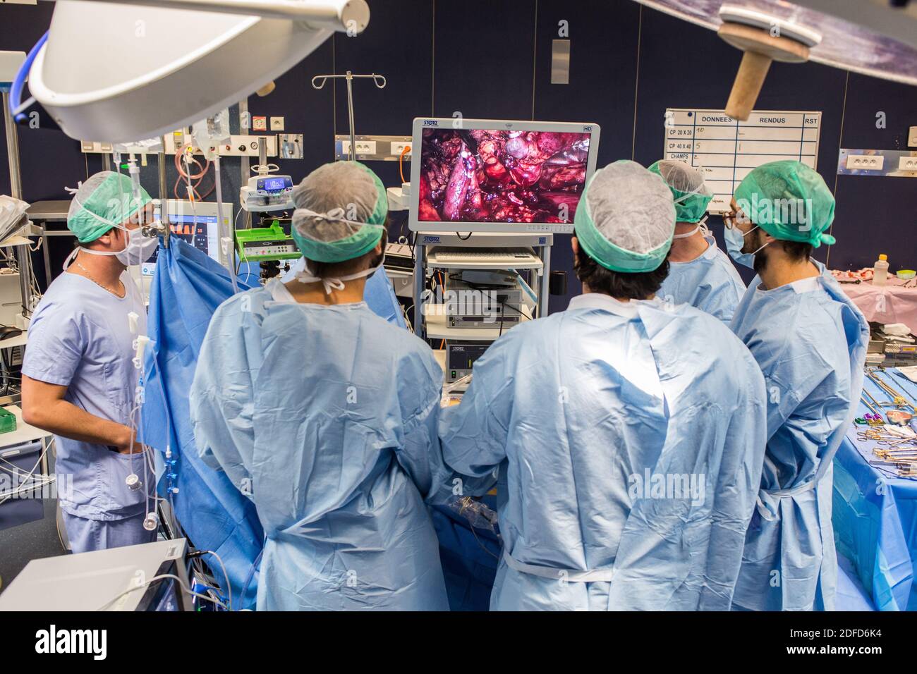 Nierenentfernung durch Laparoskopie von einem lebenden verwandten Spender, Bordeaux Krankenhaus, Frankreich. Stockfoto