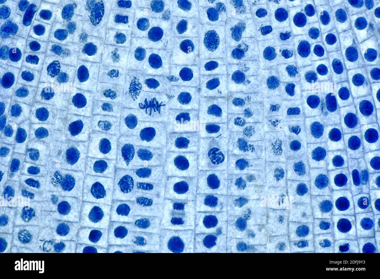 Zellteilung in Zwiebelwurzelzellen, Mitose, gefärbter Abschnitt, Hellfeld-Photomikrograph Stockfoto