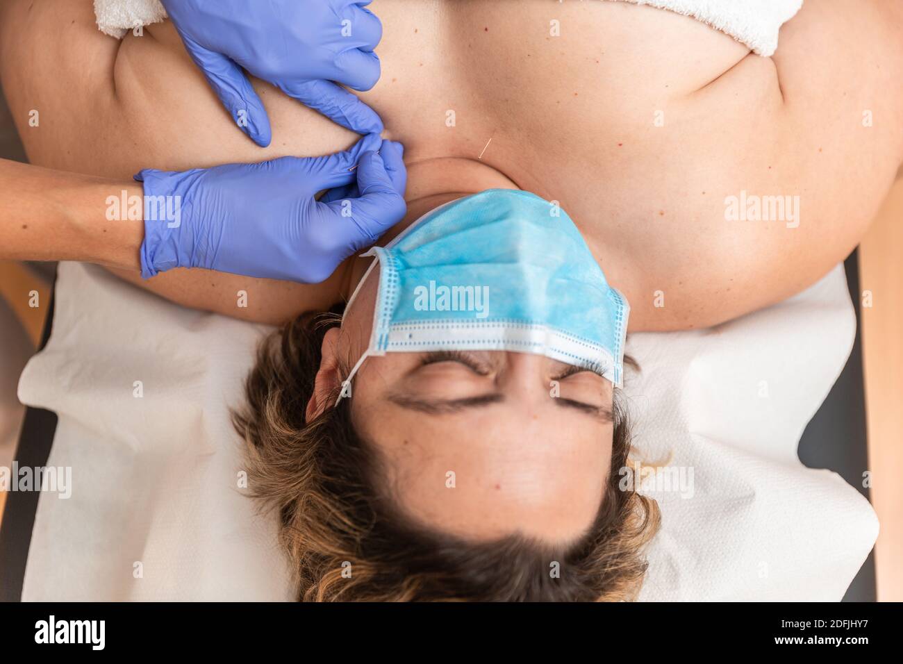 Physiotherapeutin, die Behandlung mit trockenen nadelnden Akupunktur an Patienten in der Brust, sie verwenden eine Schutzmaske Coronavirus Stockfoto