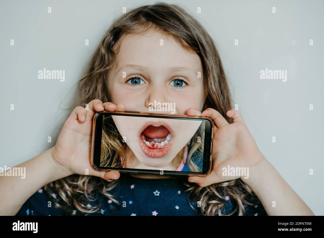 Mädchen mit einer Zahnlücke Stockfoto