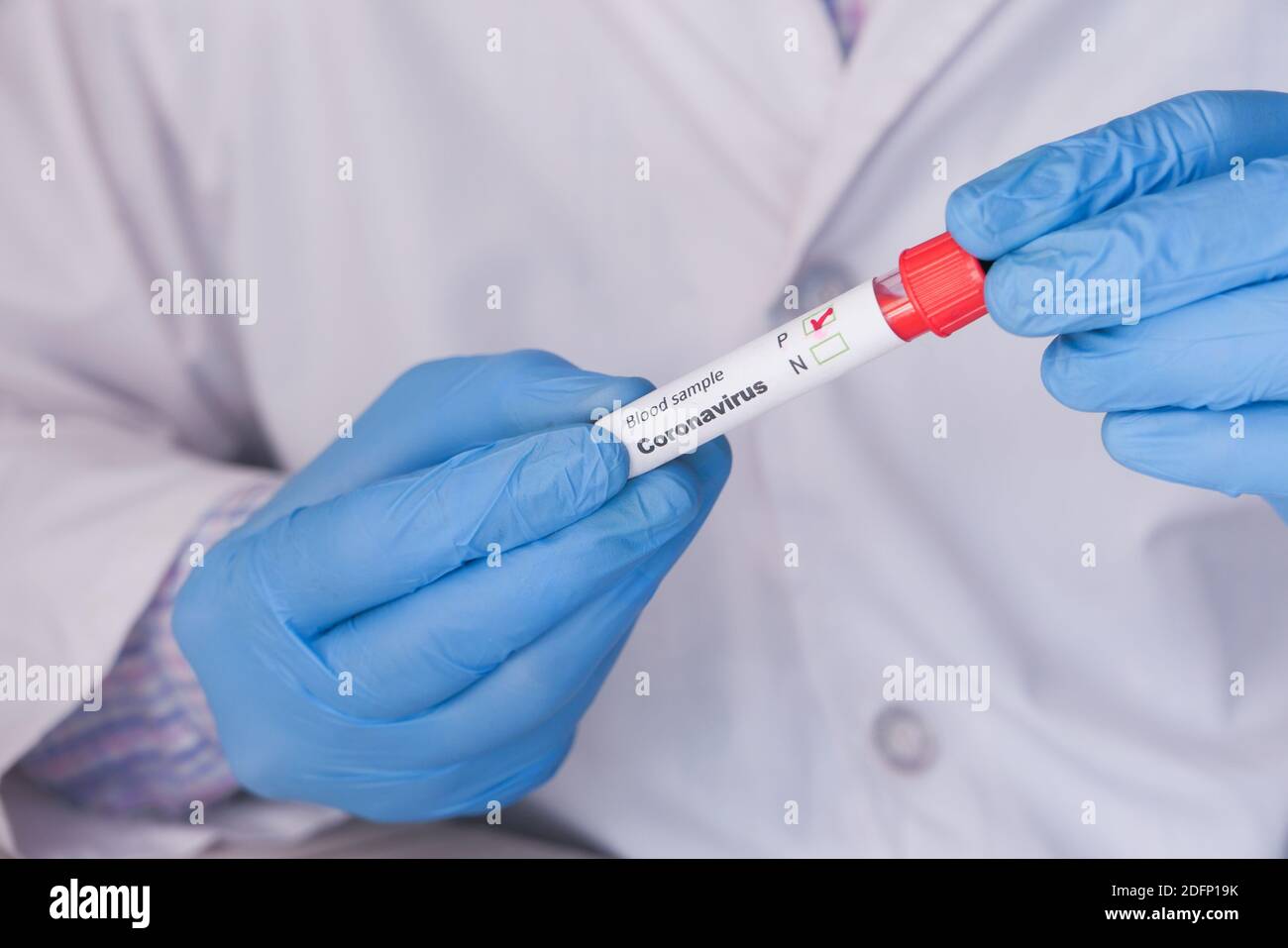 Labortechniker Hand hält Blutprobe Rohr Stockfoto