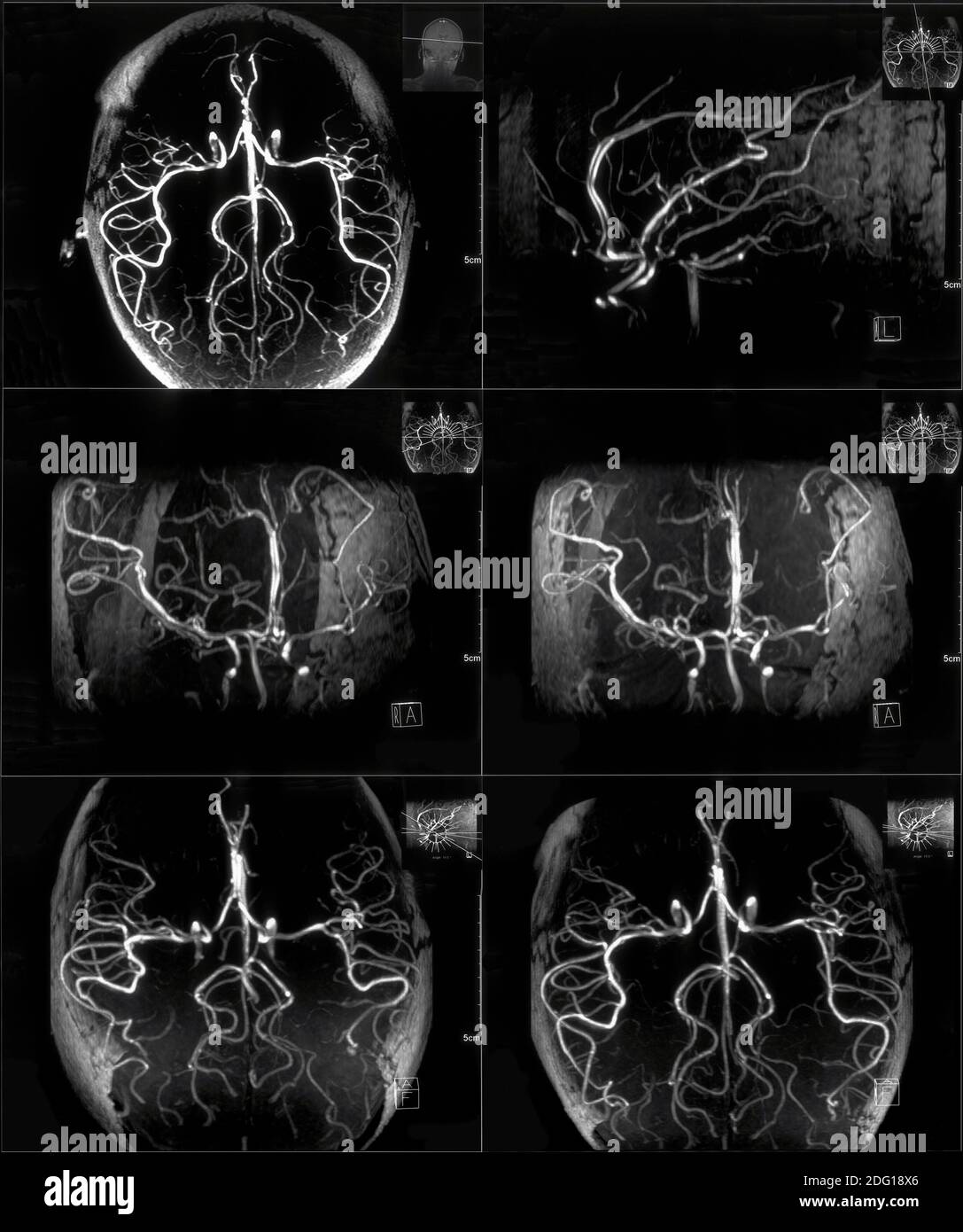 Kontrast-MRT Stockfoto