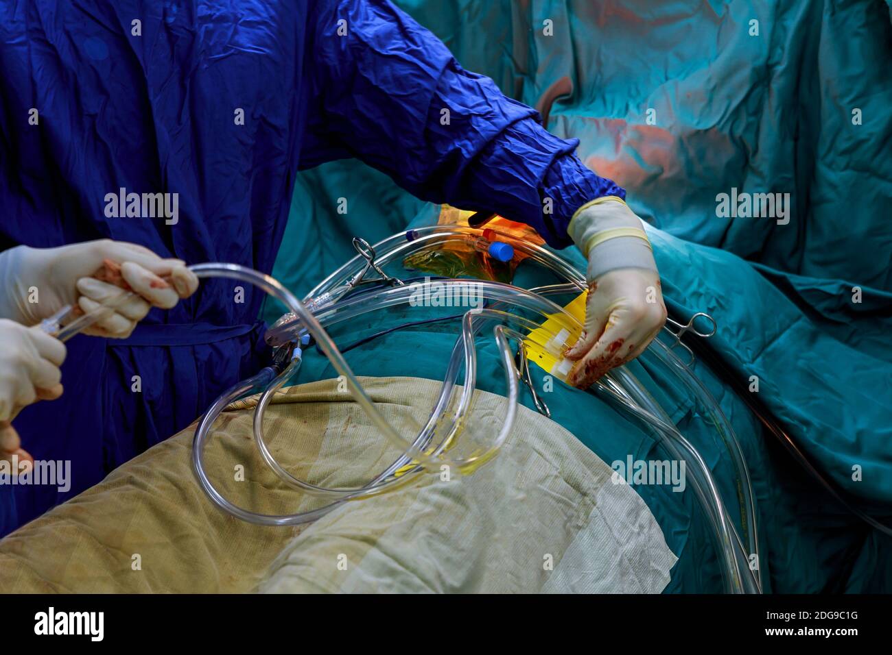 Ein Anästhesist, ein Patient für die Operation vorbereiten Stockfoto