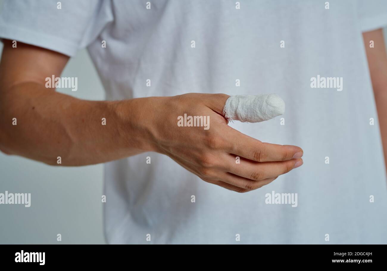 Gebrochener Finger Stockfotos und bilder Kaufen Alamy