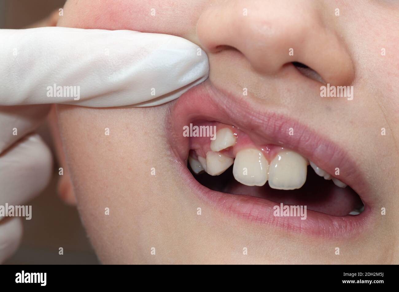 Zahngesundheit kinder Fotos und Bildmaterial in hoher Auflösung Alamy