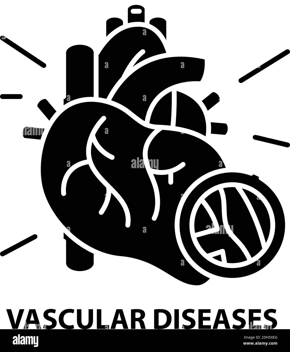 Symbol für Gefäßerkrankungen, schwarzes Vektorzeichen mit editierbaren Konturen, Konzeptdarstellung Stock Vektor