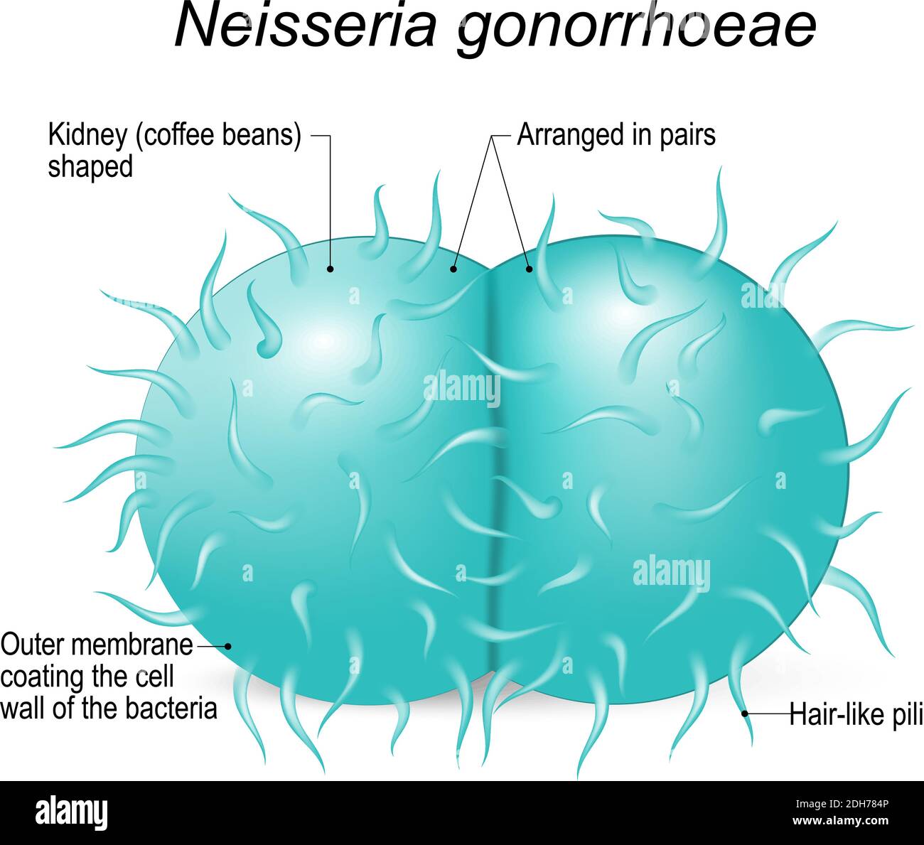 Neisseria gonorrhoeae (gonococcus) ist eine gram-negative Diplokokken Bakterien verursacht die Sexuell übertragbare Urogenitalinfektion - Gonorrhoe Stock Vektor