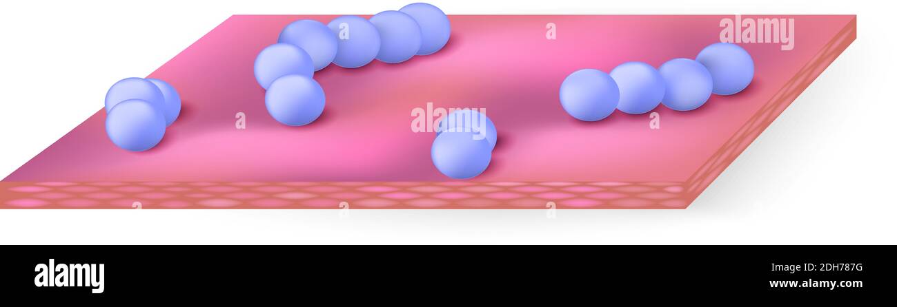 Die Bakterien auf der Hautoberfläche (in den Atemwegen oder Verdauungstrakt). Streptococcus ist eine Gattung sphärische Gram-positive Bakterien Stock Vektor