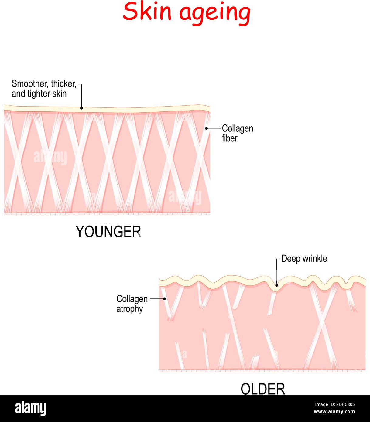 Visuelle Darstellung von Hautveränderungen über ein Leben. In Young Skin Collagen und Elastin bilden die Struktur der Dermis macht es eng und plump. Stock Vektor
