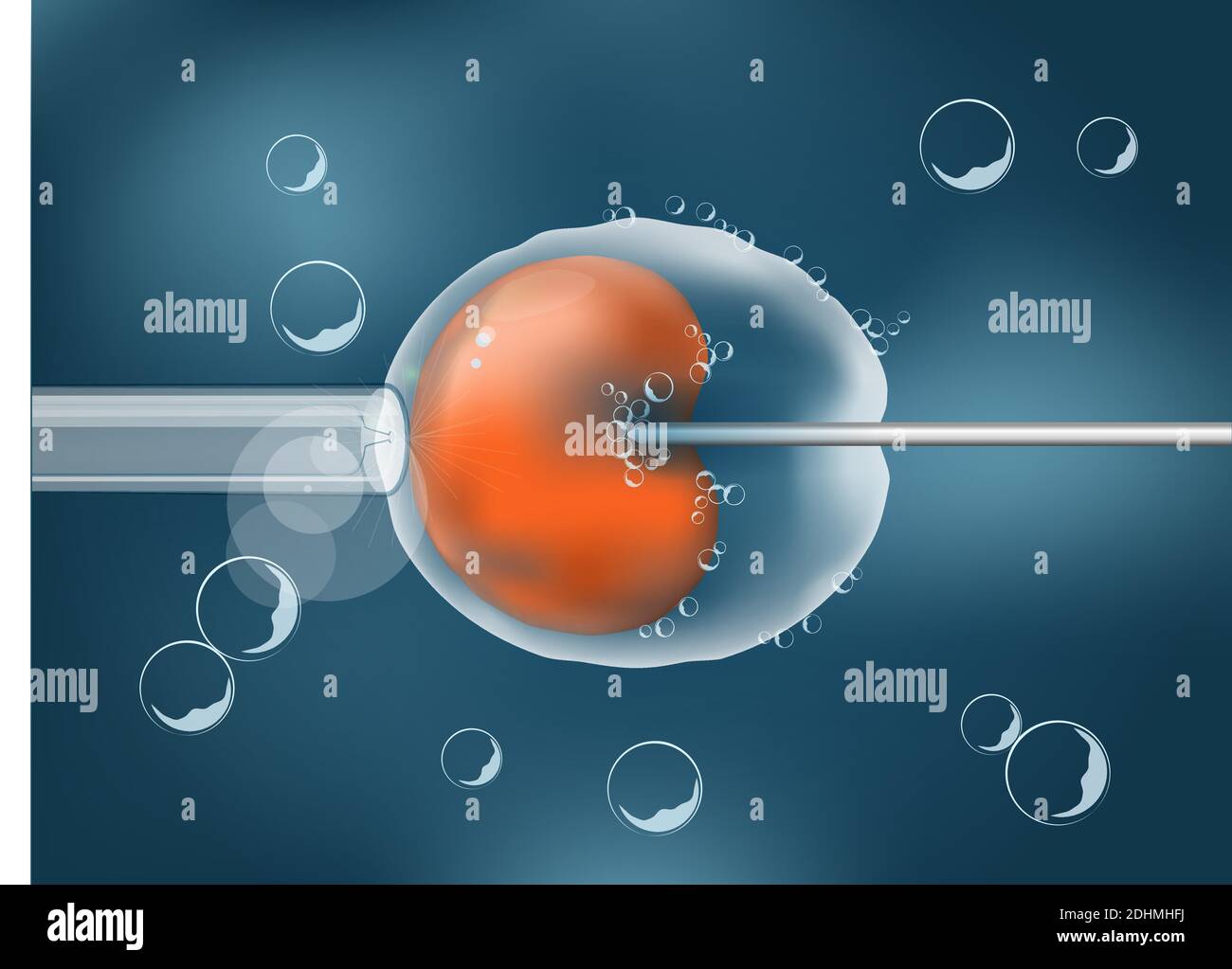 In-vitro-Fertilisation. IVF. Zelle unter dem Mikroskop. Menschliches Ei auf grauem Hintergrund. vektor. Illustration leicht editierbar für Ihre Hintergrundfarbe. Stock Vektor