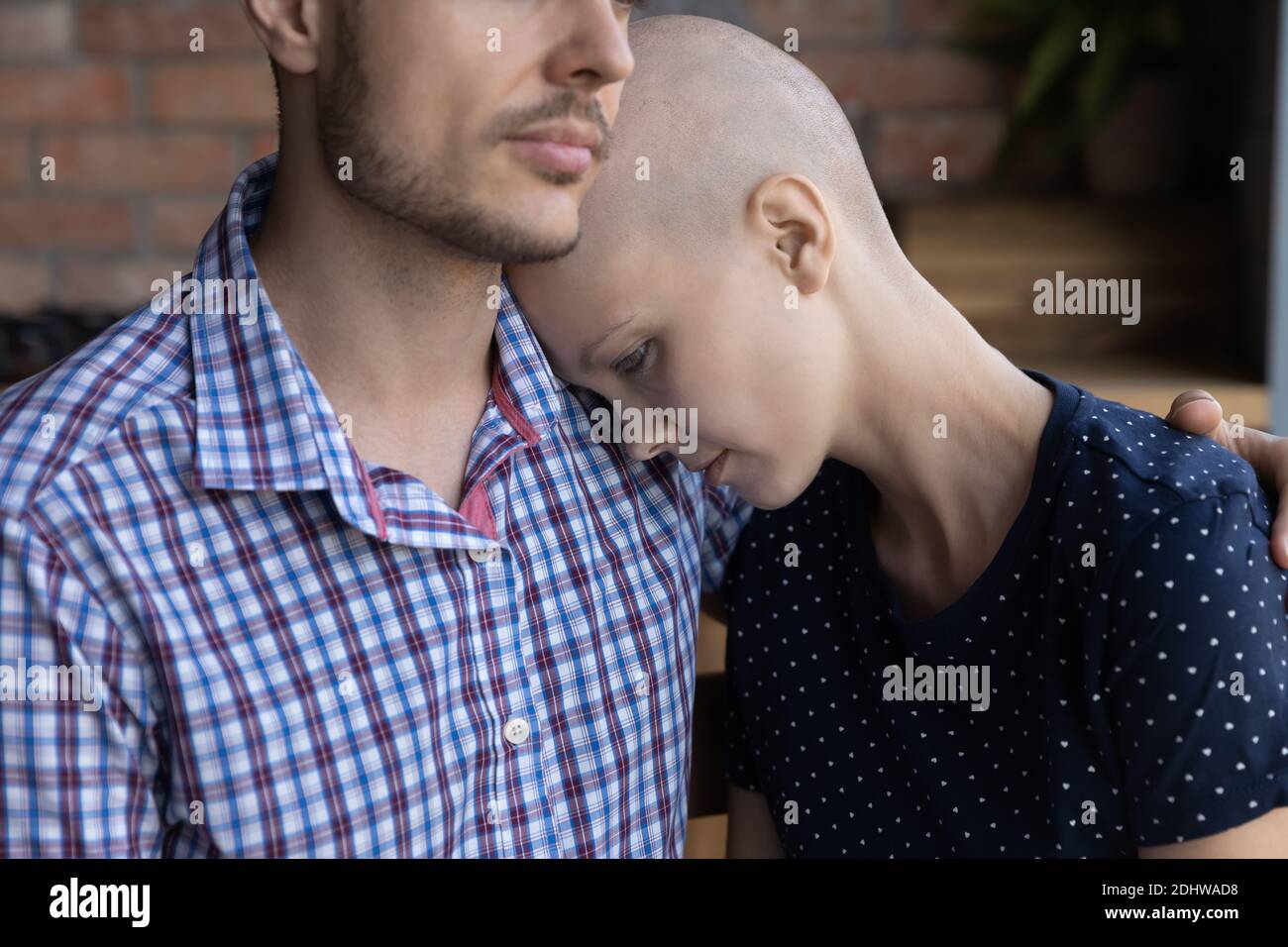 Nahaufnahme liebevoller Ehemann beruhigend krank haarlos Frau Krebs-Patient Stockfoto