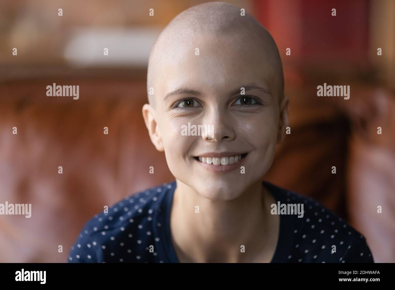Kopf erschossen Porträt lächelnd haarlos Frau Krebs Patient posiert Stockfoto