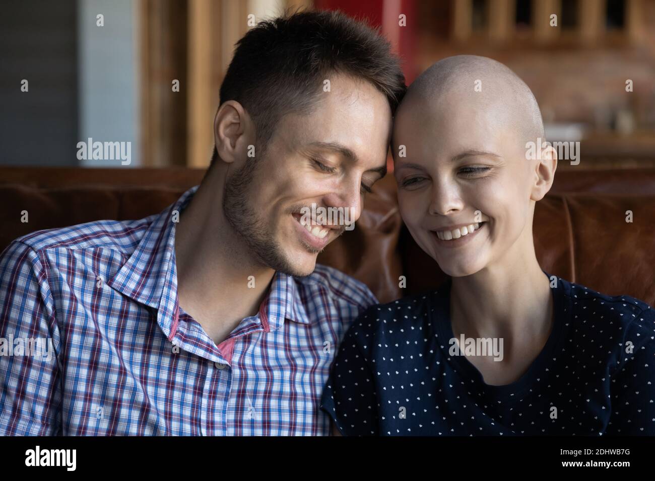 Nahaufnahme lächelnde haarlose Frau und Mann berühren Stirn Stockfoto