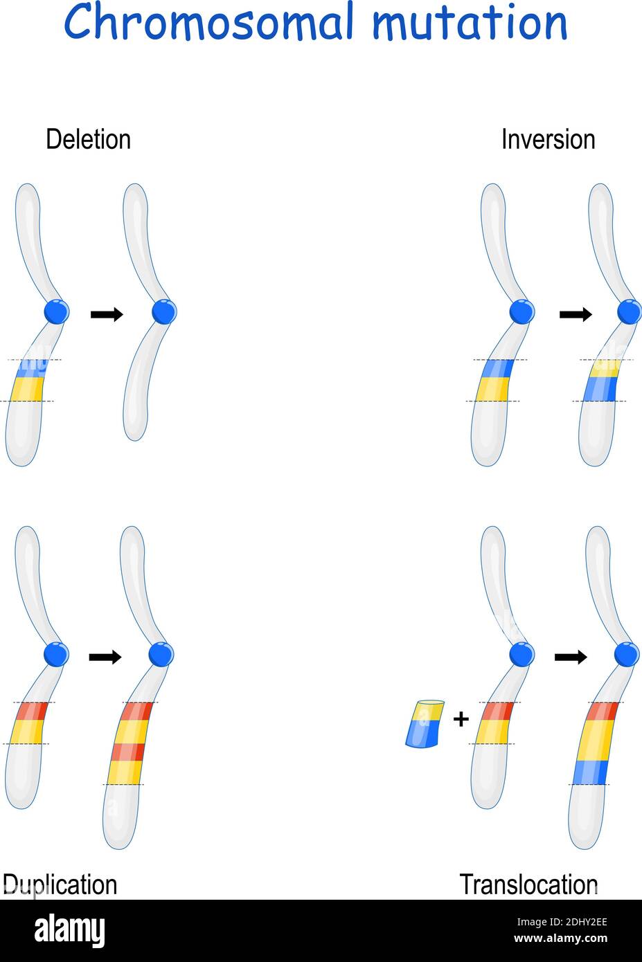 Chromosomale Mutation: Inversion, Duplikation, Translokation, Deletion. Anomalie genetische Störung. Veränderungen, die sich auf Wachstum, Entwicklung auswirken Stock Vektor