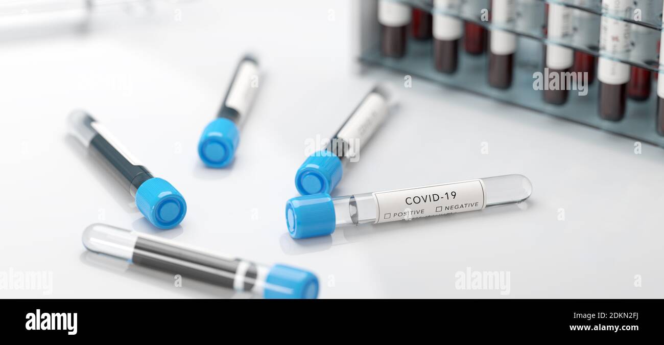 Tests auf Coronavirus Covid-19 in einem Labor. Medizinische Screening und Covid Tests Produktion. Stockfoto