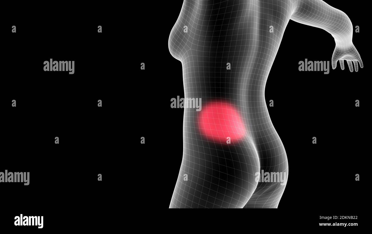 3d-Darstellung eines Frauen-Röntgenhologramms mit Schmerzbereich Auf der Rückseite Stockfoto