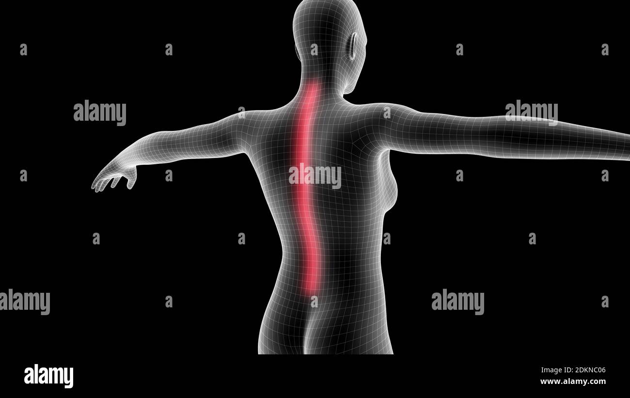 3d-Darstellung eines Frauen-Röntgenhologramms mit Schmerzbereich Auf der Rückseite Stockfoto