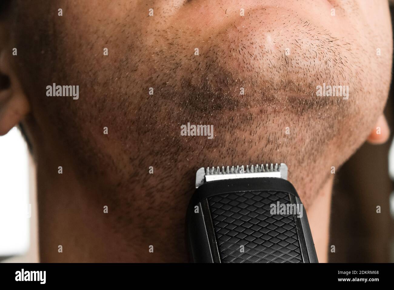 Mann, der seinen kurzen Stoppeln rasiert. Irritation nach elektrischen Rasiermesser Rasur Konzept. Stockfoto