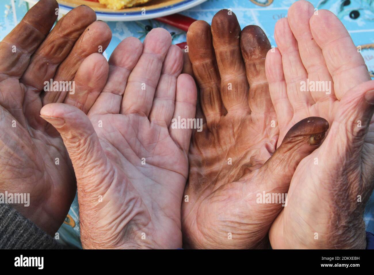 Die Hände von zwei älteren Mann, einer von ihnen durch das Jod in schwarzen Walnüssen befleckt. Essen mit schmutzigen Händen. Stockfoto