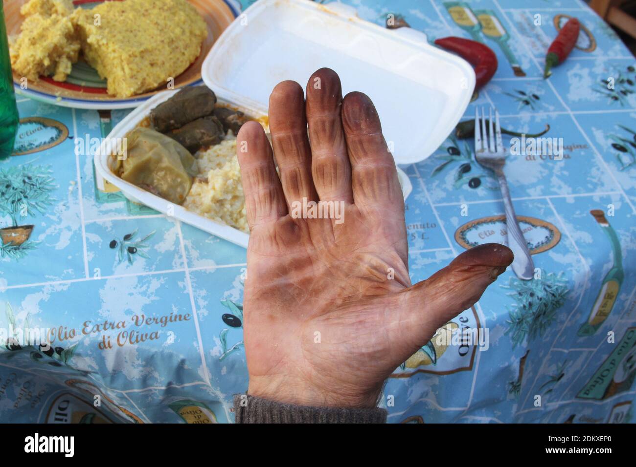 Die Hand eines älteren Mannes, befleckt durch das Jod in schwarzen Walnüssen. Schmutzige Hand. Stockfoto