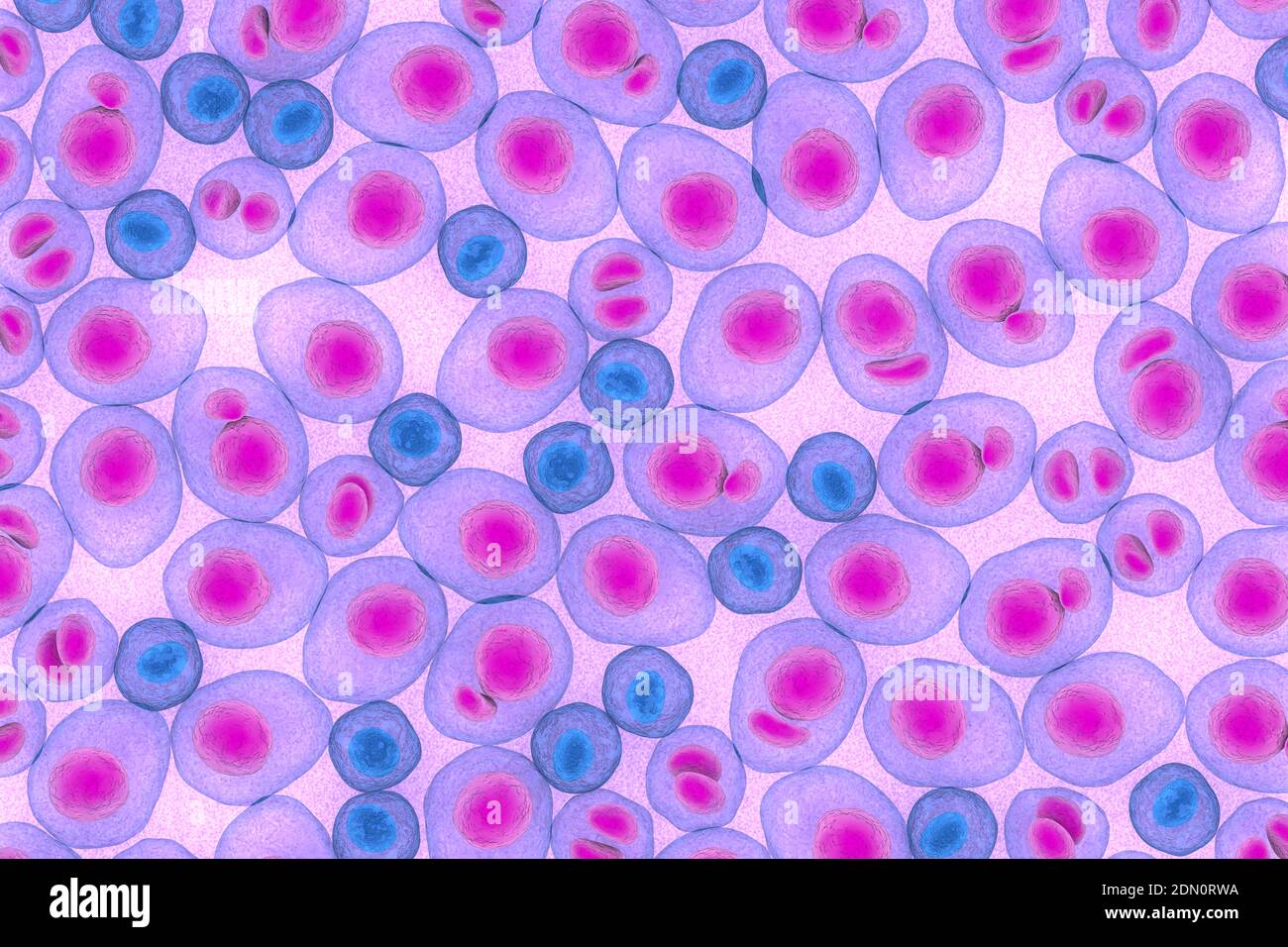 Myelom Multiplex Leukämie Krebs 3d Farbe rendern Illustration Stockfoto