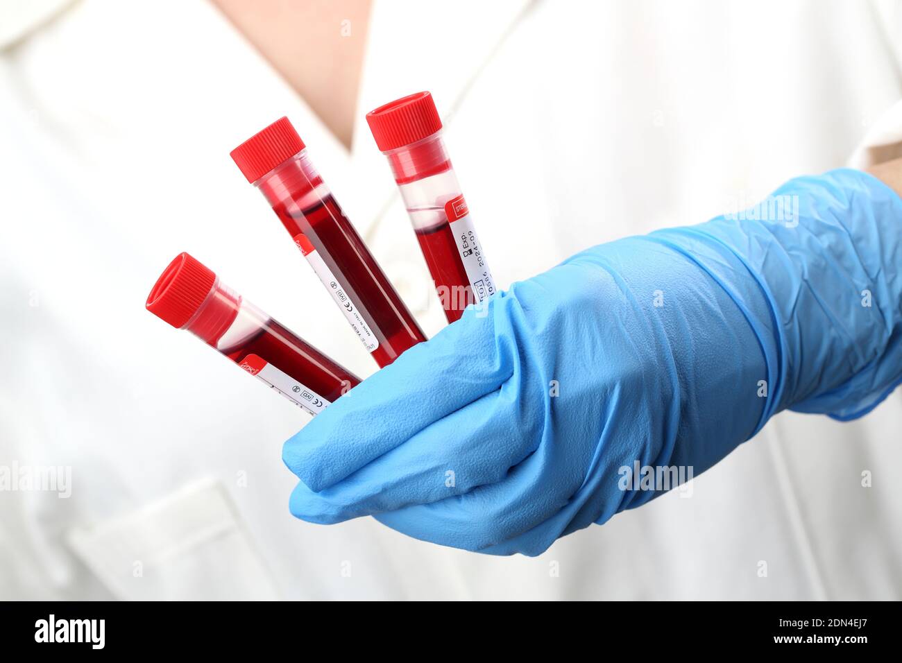 Bluttests, Blut in einem Reagenzglas, Antikörperforschung, Test Stockfoto