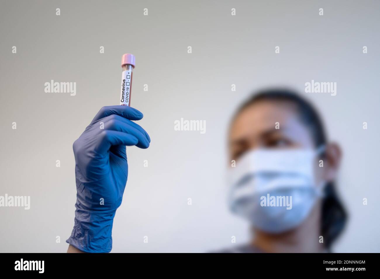 Wissenschaftler, der medizinische Proben im Reagenzglas hält Stockfoto
