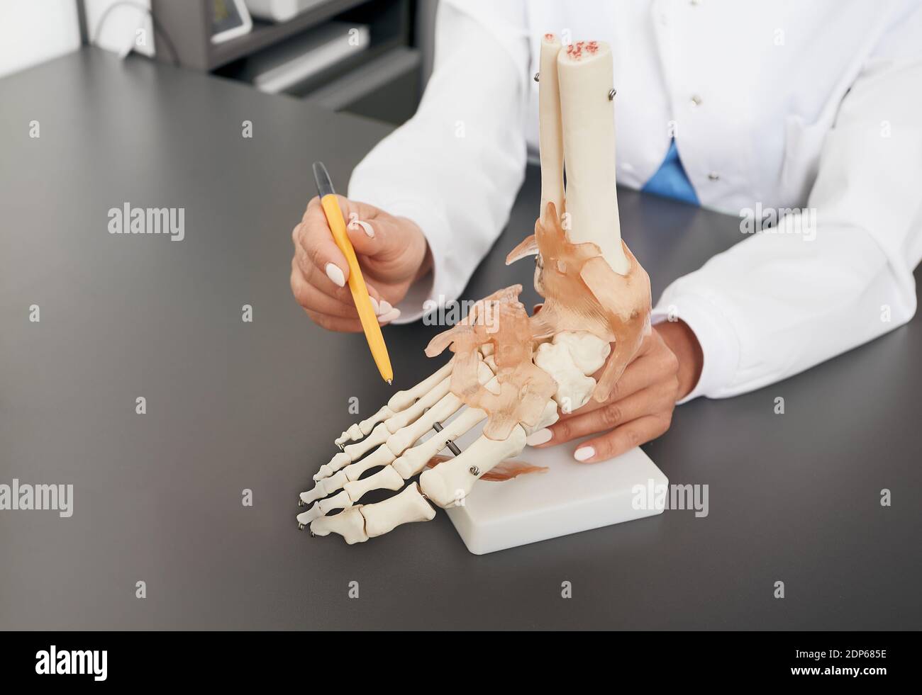 Der Arzt Orthopäden zeigt das anatomische Modell des Fußes. Arthritis, Fussverletzungen, Plattfüße und Schmerzen Stockfoto