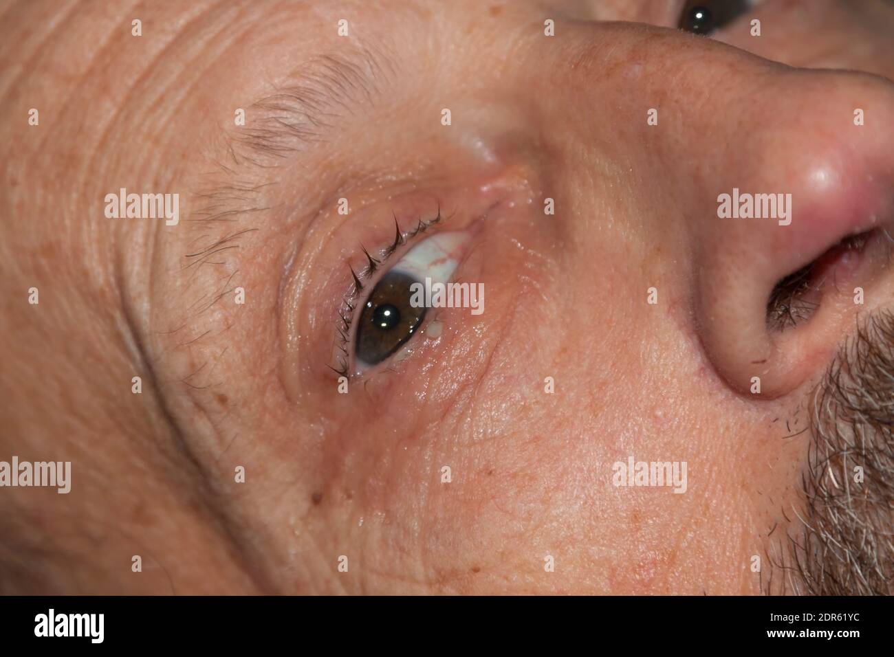 Ängstlicher alter Mann im Pflegeheim Stockfoto