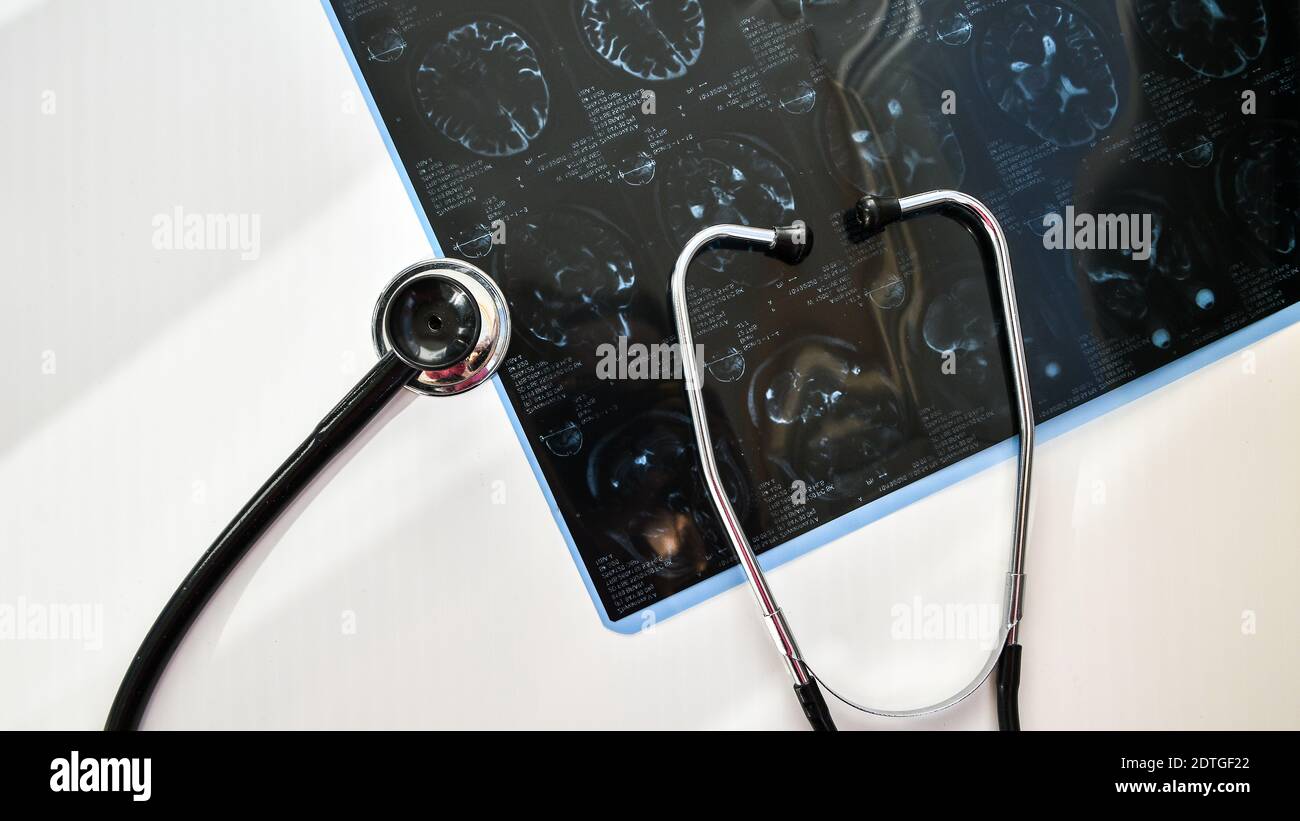 MRT in der medizinischen Praxis. MRT des menschlichen Kopfes in der Klinik mit Stethoskop. Draufsicht auf den Tisch des Arztes Stockfoto