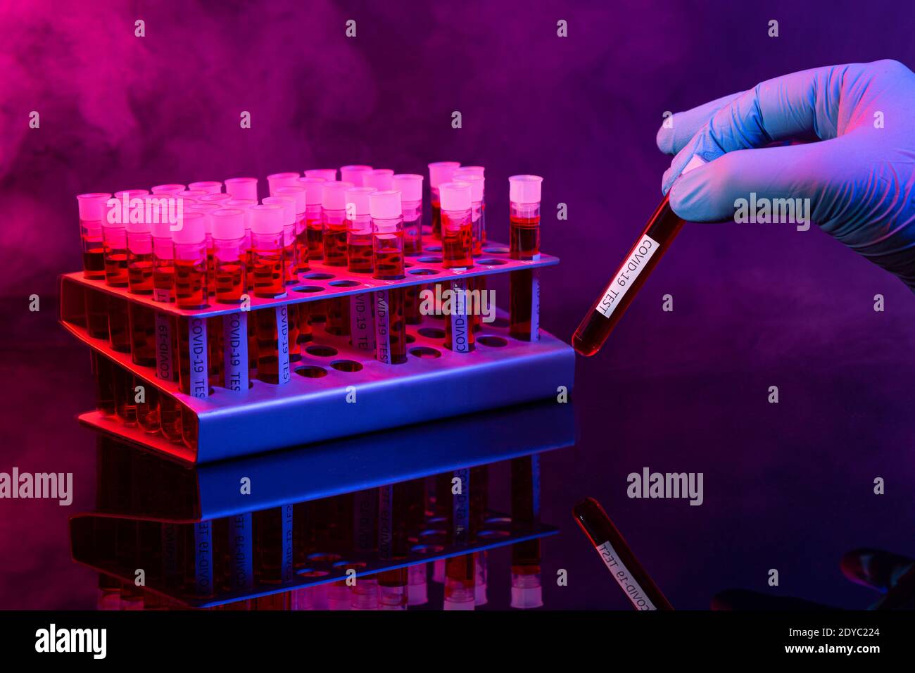 Teströhrchen für Coronavirus-Infektion zu testen. Covid-19 und Pandemie globales Konzept . Stockfoto