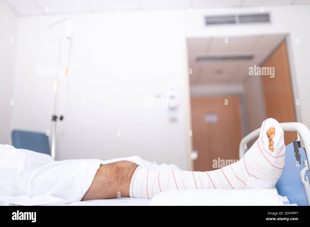 Patient liegt im Krankenhausbett mit gebrochenem Bein. Krankenhausaufenthalt und medizinisches Versorgungskonzept. Stockfoto