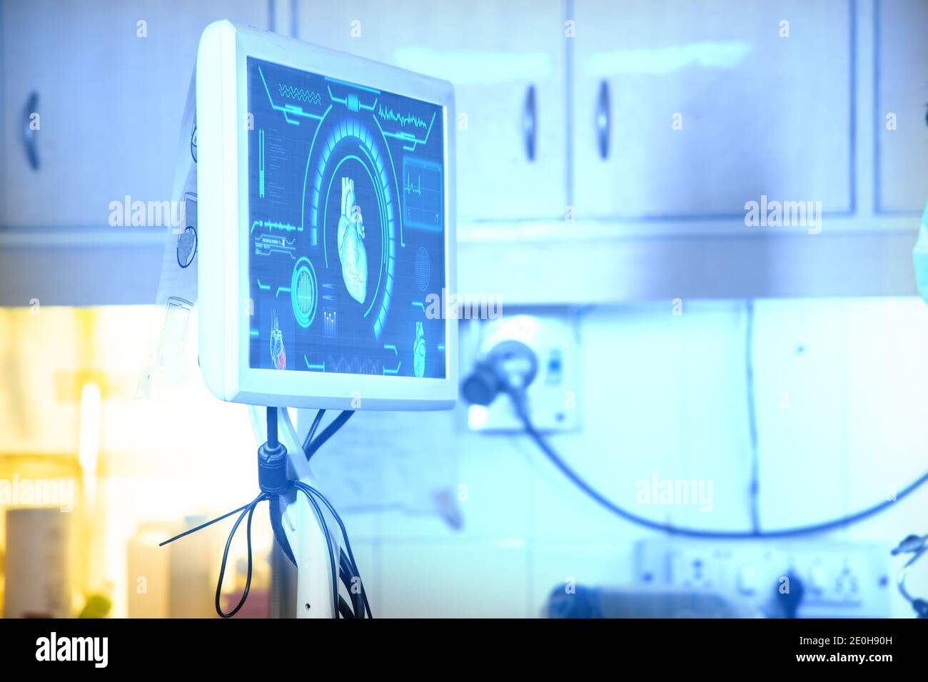 Computerbildschirm der Scanmaschine im Krankenhaus. Moderne medizinische Ausrüstung. Digitale Diagnosetechnik, Herzkrankheitskonzept, Hintergrund, Polizist Stockfoto