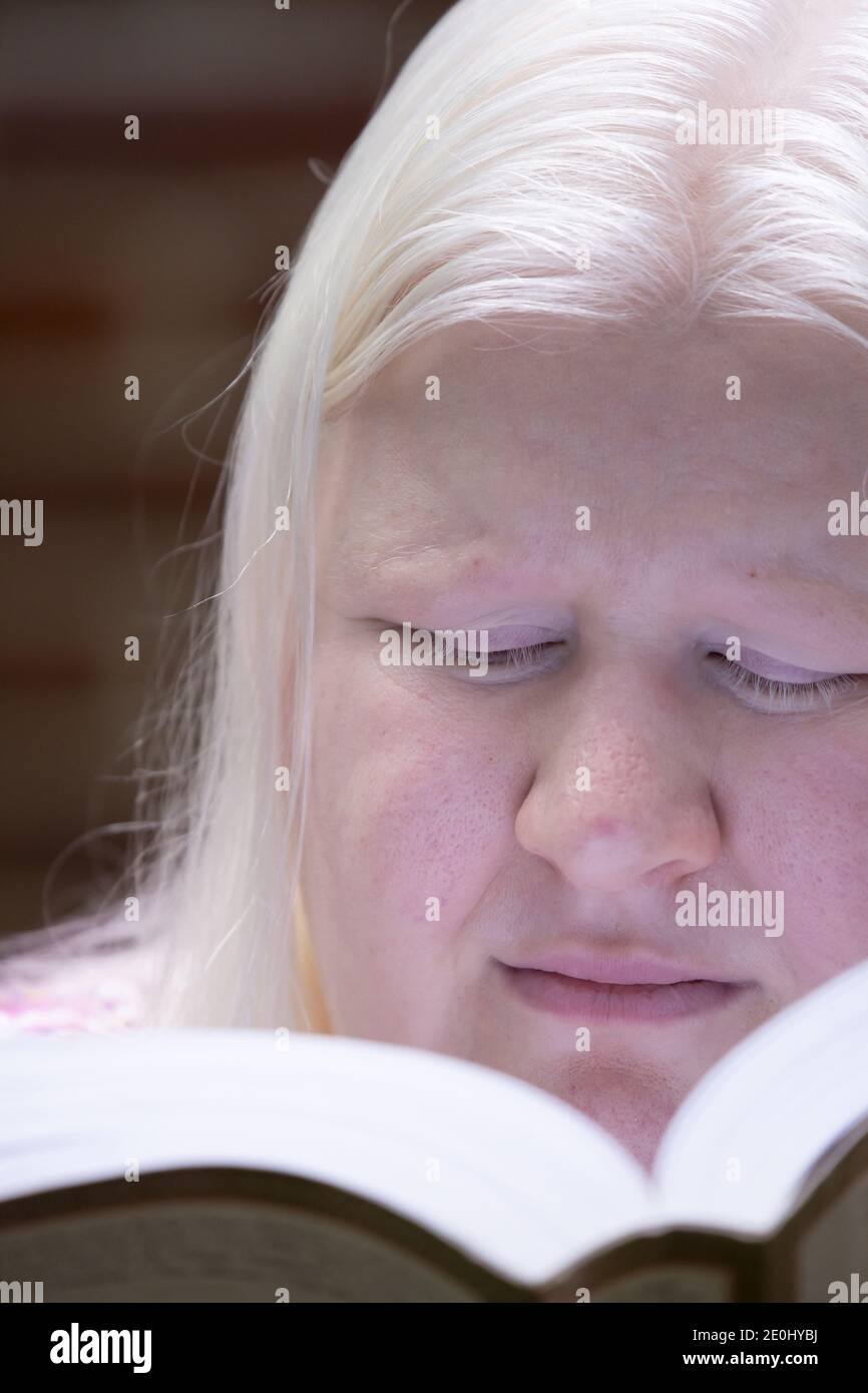 Legal blinde Albino Frau, die draußen ein Buch liest Stockfoto
