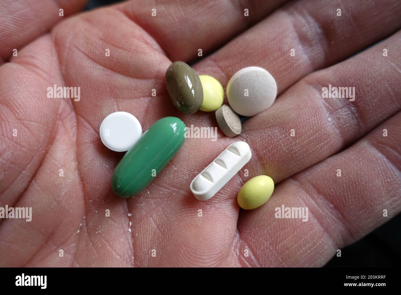 Öffne Hand mit mehreren Tabletten - Symbolbild für Medikamentenabhängigkeit Stockfoto