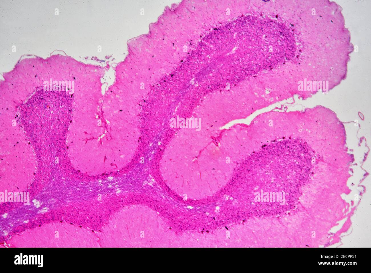 Menschliches Nervensystem, Kleinhirn Motor Cortex. X25 bei 10 cm Breite. Stockfoto