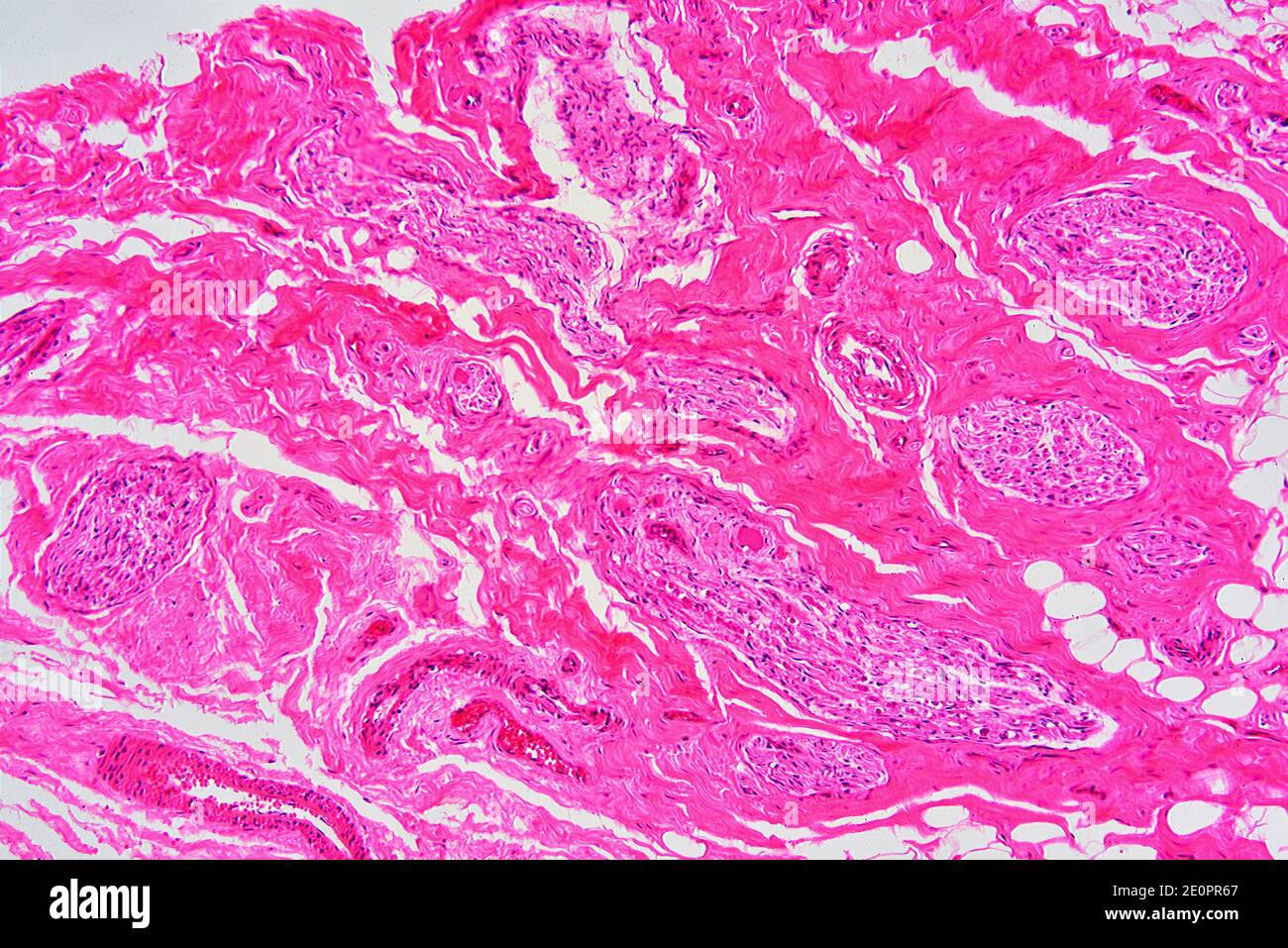 Humane Nabelschnur-Schleimhäute mit Schleimdrüsen, lockeres konjektives Gewebe, Adipozyten, glatten Muskelfasern und Blutgefäßen. X 75 bei 10 cm Breite. Stockfoto