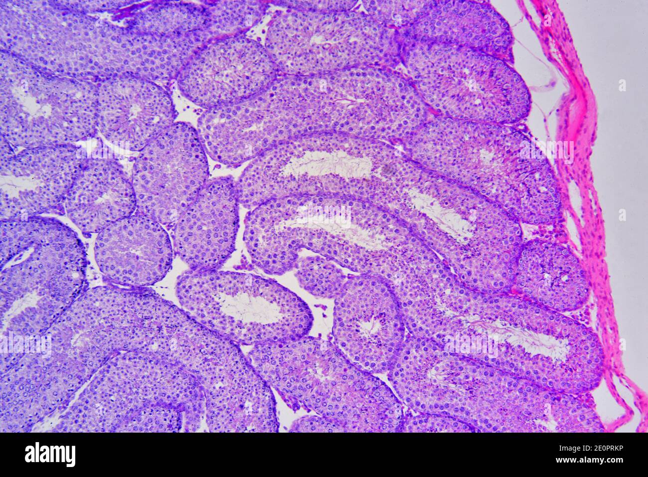 Rabbit Hoden zeigt von rechts nach links: Parietalschicht und Samenbläschenlobullen mit Spermien. Photomikrograph X75 mit einer Breite von 10 cm. Stockfoto