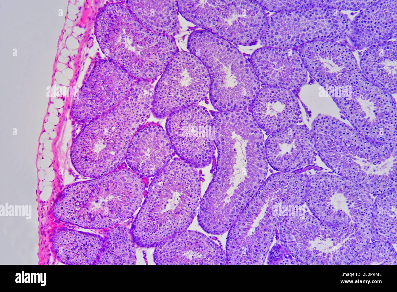 Kaninchenhoden von links nach rechts: Parietalschicht und Samenbläschenlobulus mit Spermien. Photomikrograph X75 mit einer Breite von 10 cm. Stockfoto