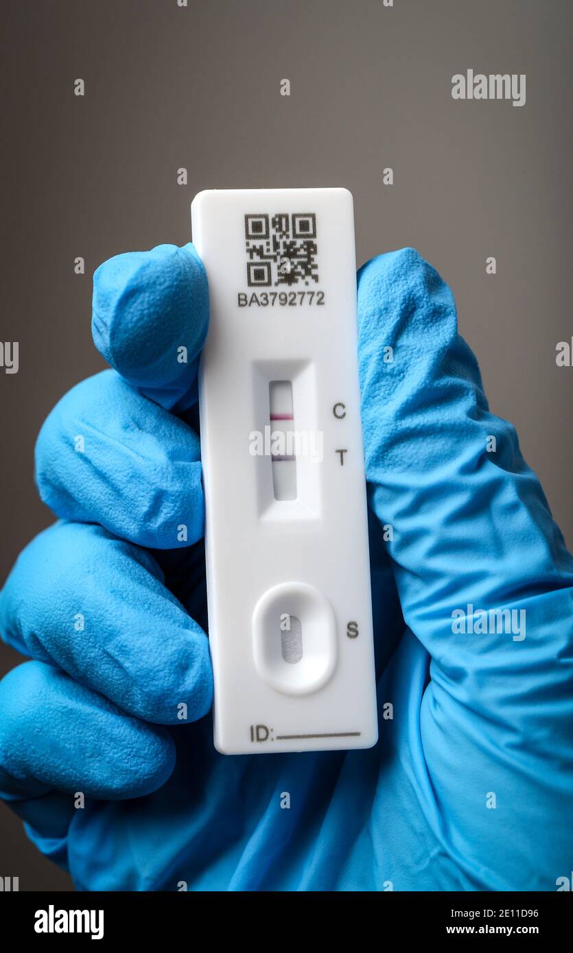 Coronavirus-Test mit einem Lateral Flow Device zeigt der Test ein positives Ergebnis, der Patient hat Coronavirus. Stockfoto