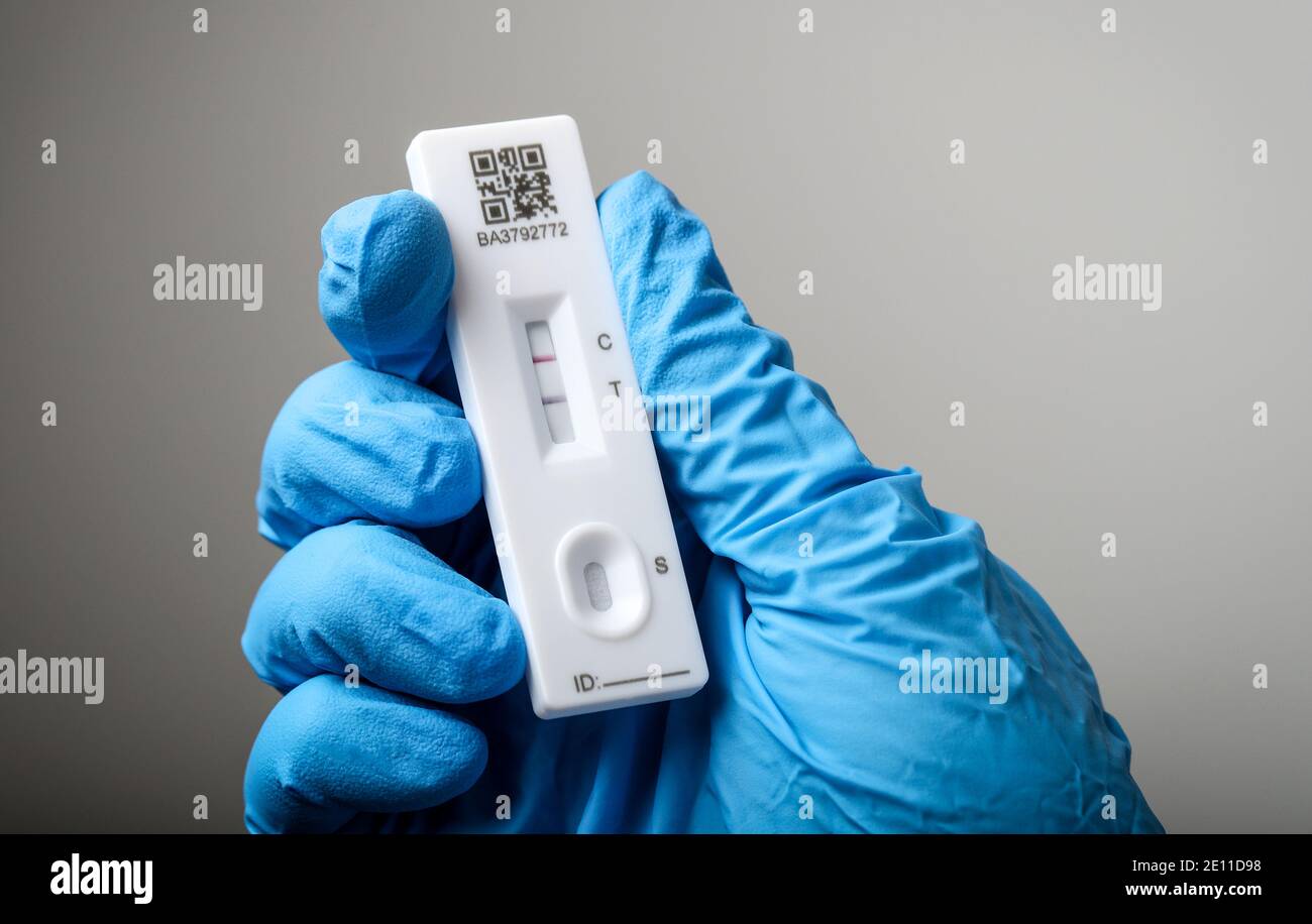 Coronavirus-Test mit einem Lateral Flow Device zeigt der Test ein positives Ergebnis, der Patient hat Coronavirus. Stockfoto