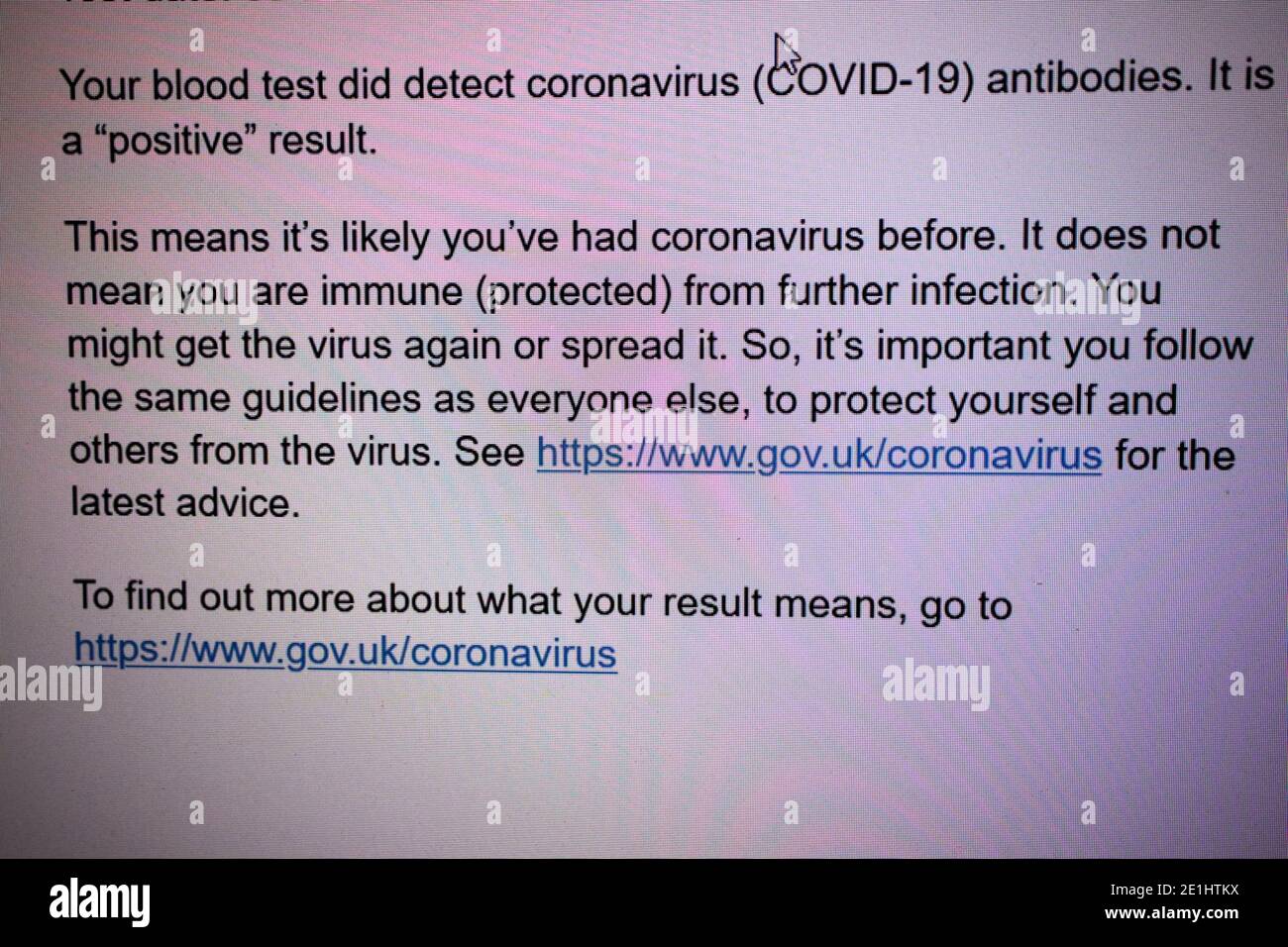 Bildschirmmeldung, die ein positives Ergebnis eines nhs ergibt Covid-19-Antikörper-Bluttest auf Coronavirus-Antikörper, die in empfangen wurden vereinigtes Königreich Stockfoto