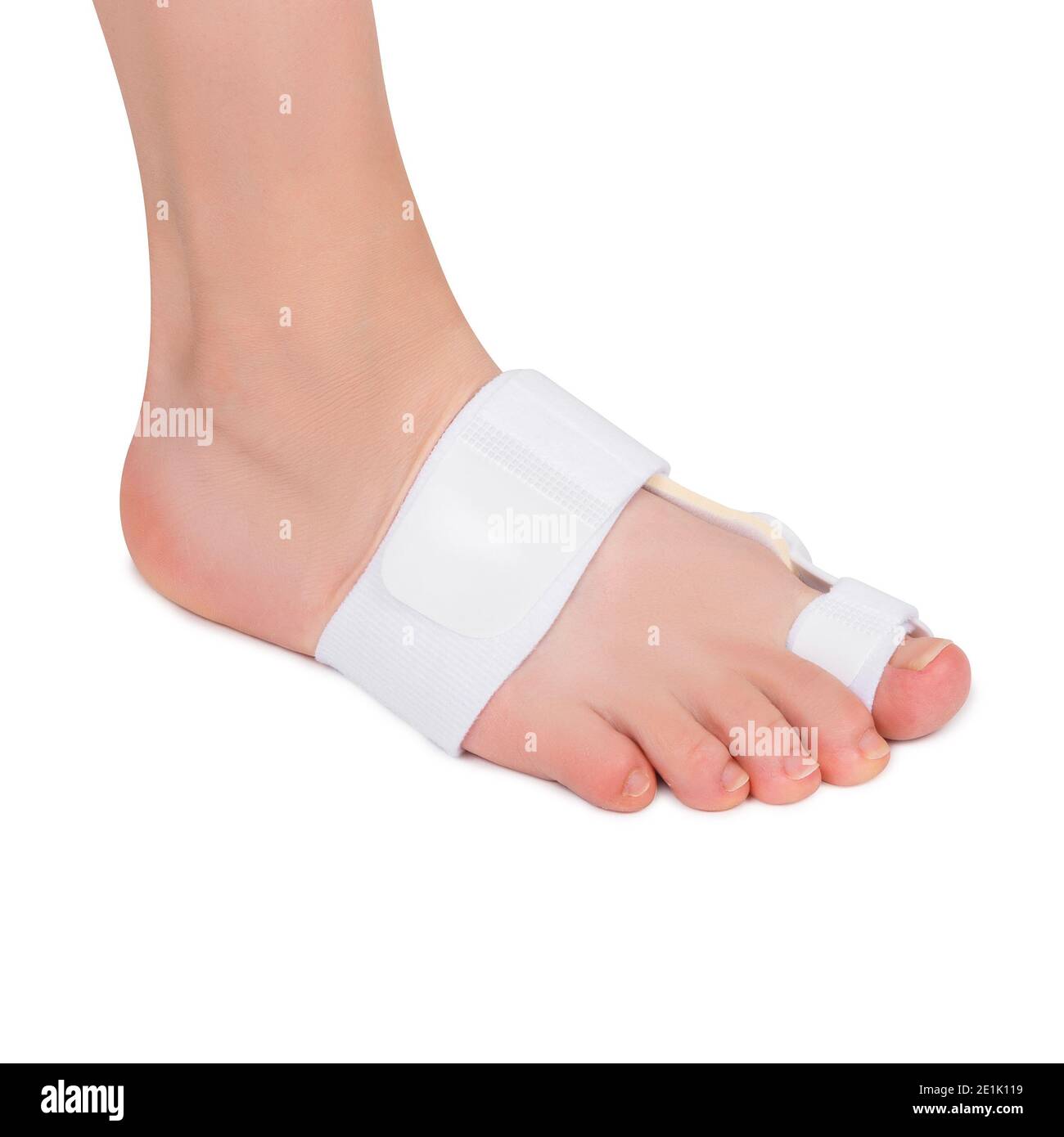 Weiblicher Fuß mit Bunion Korrektor einer großen Zehe. Überdruckschutz. Stockfoto