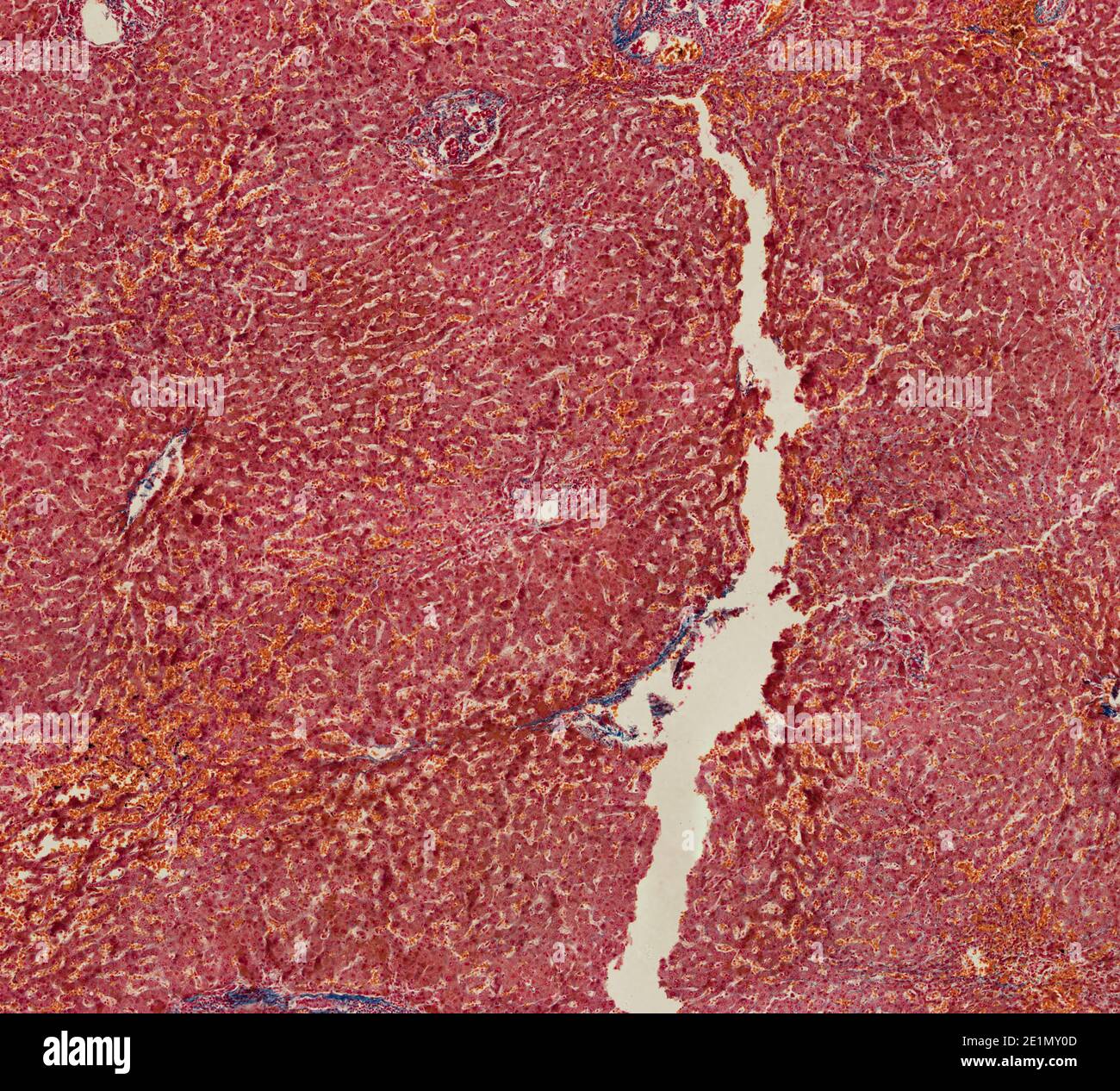 Rote Blutkörperchen Unter Dem Mikroskop Stockfotos und -bilder Kaufen -  Alamy
