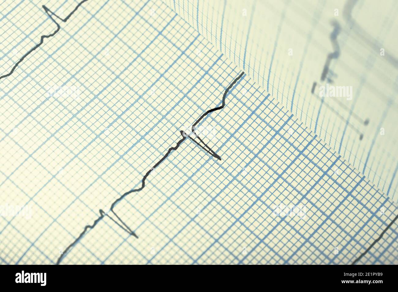 EKG-Papier als medizinischer Hintergrund. Stockfoto