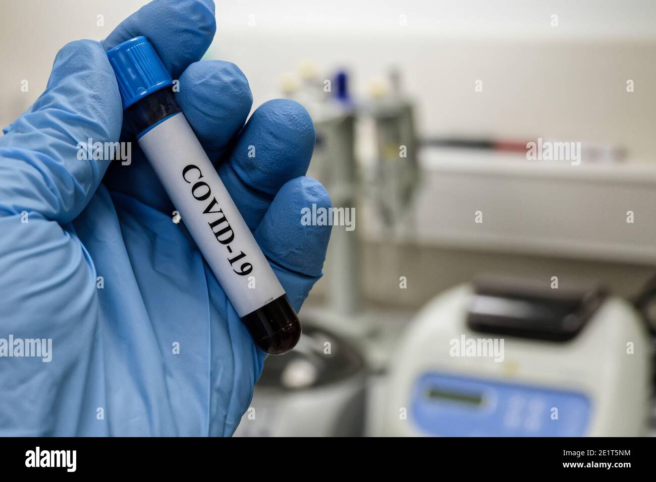 Coronavirus-Test. Nachweis von Antikörpern gegen COVID-19 in einer Blutprobe. Stockfoto