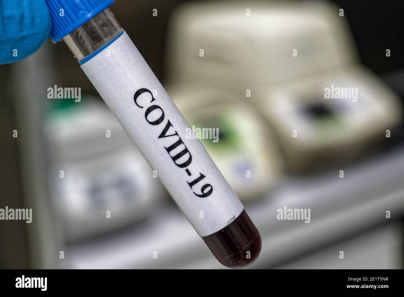 Coronavirus-Test. Nachweis von Antikörpern gegen COVID-19 in einer Blutprobe. Stockfoto