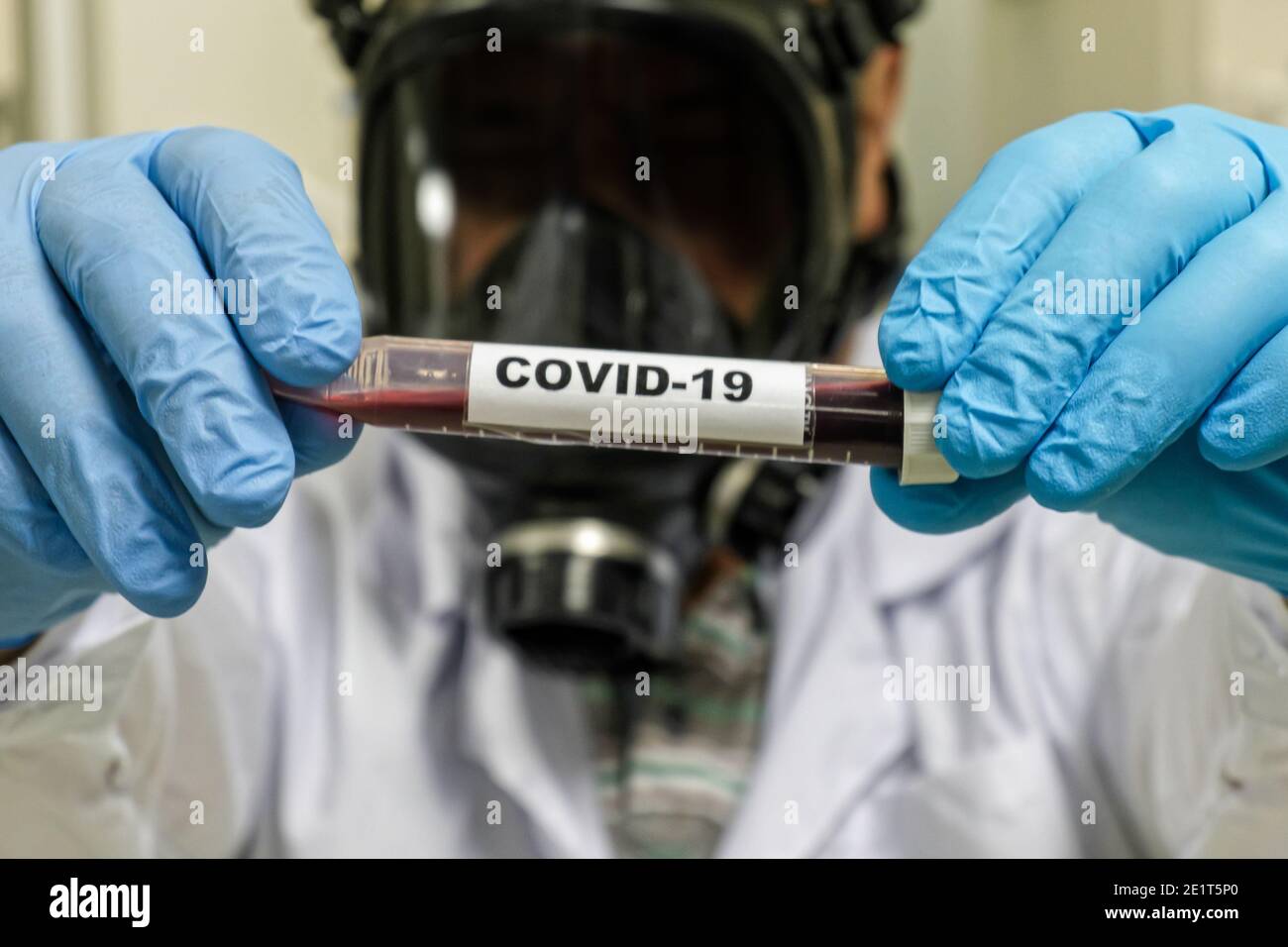 Coronavirus-Test. Nachweis von Antikörpern gegen COVID-19 in einer Blutprobe. Stockfoto