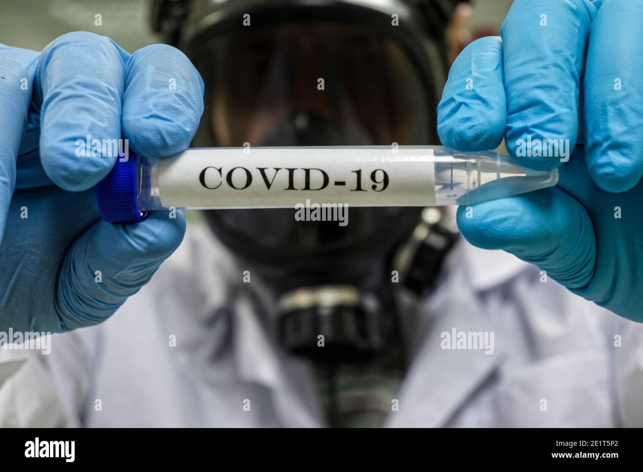 Coronavirus-Test. Nachweis von Antikörpern gegen COVID-19 in einer Blutprobe. Stockfoto